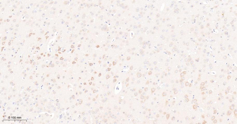 雷帕霉素靶蛋白重组兔单抗-bsm-54471R