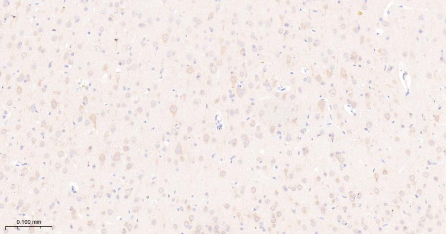 雷帕霉素靶蛋白重组兔单抗-bsm-54471R