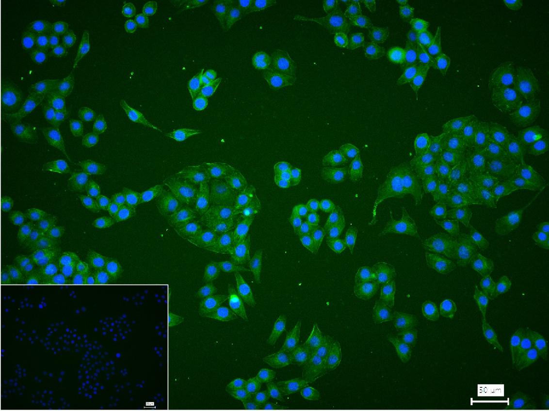 原癌基因蛋白c-kit（CD117）重组兔单抗-bsm-52036R