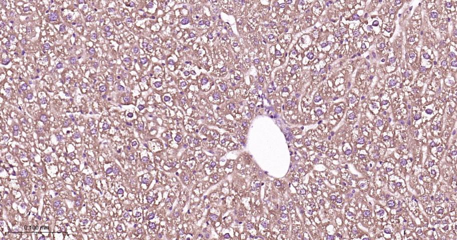 瘦素受体重组兔单抗-bsm-61055R