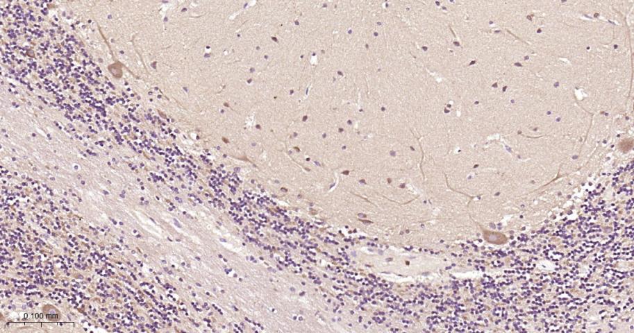 瘦素受体重组兔单抗-bsm-61055R