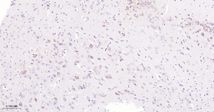 细胞信号转导分子Smad-2重组兔单抗-bsm-52223R