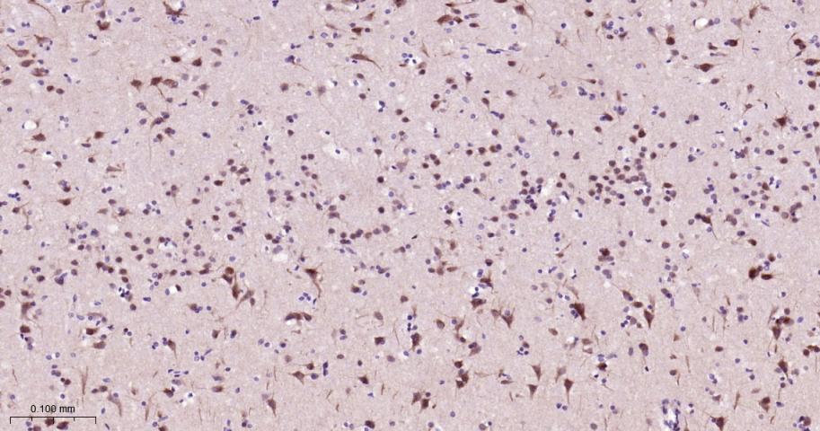 细胞信号转导分子Smad-2重组兔单抗-bsm-52223R