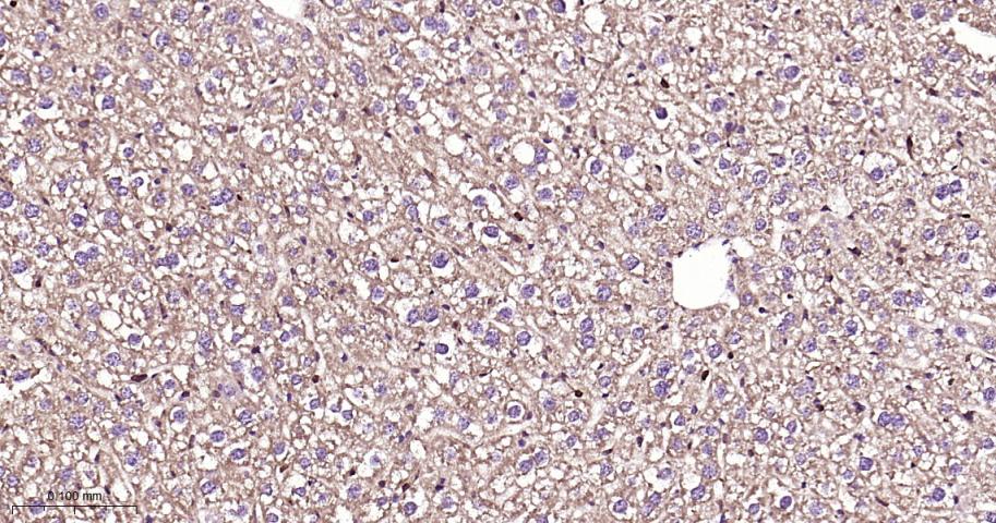 细胞信号转导分子SMAD3重组兔单抗-bsm-52224R