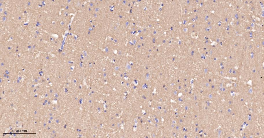 神经细胞粘附分子配体1重组兔单抗-bsm-52926R