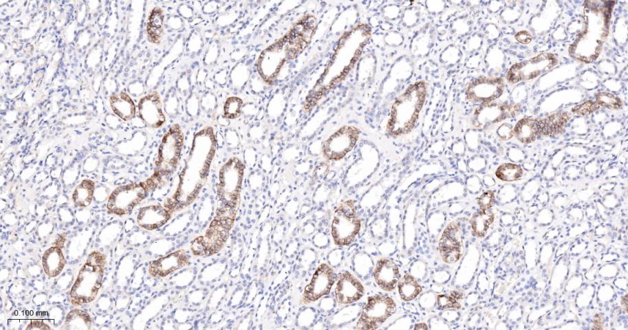 神经细胞粘附分子配体1重组兔单抗-bsm-52926R