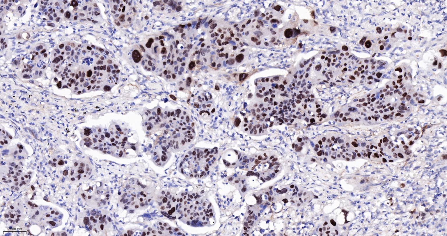 甲状腺核转录因子-1重组兔单抗-bsm-60241R