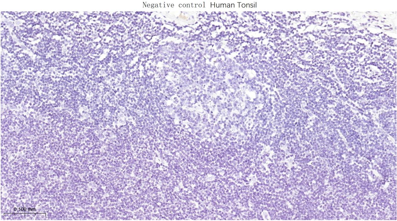 甲状腺核转录因子-1重组兔单抗-bsm-60241R