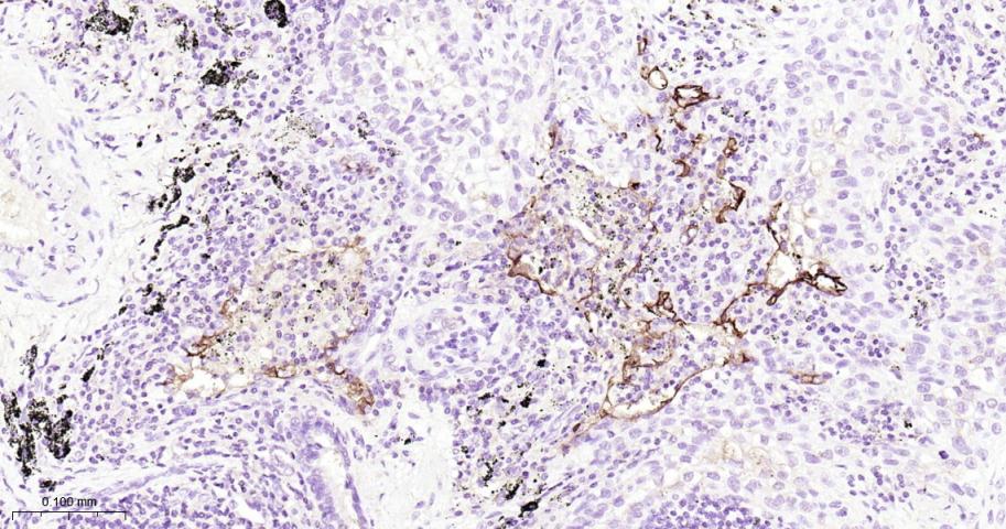 细胞间粘附分子-1（CD54）单克隆抗体-bsm-10697M