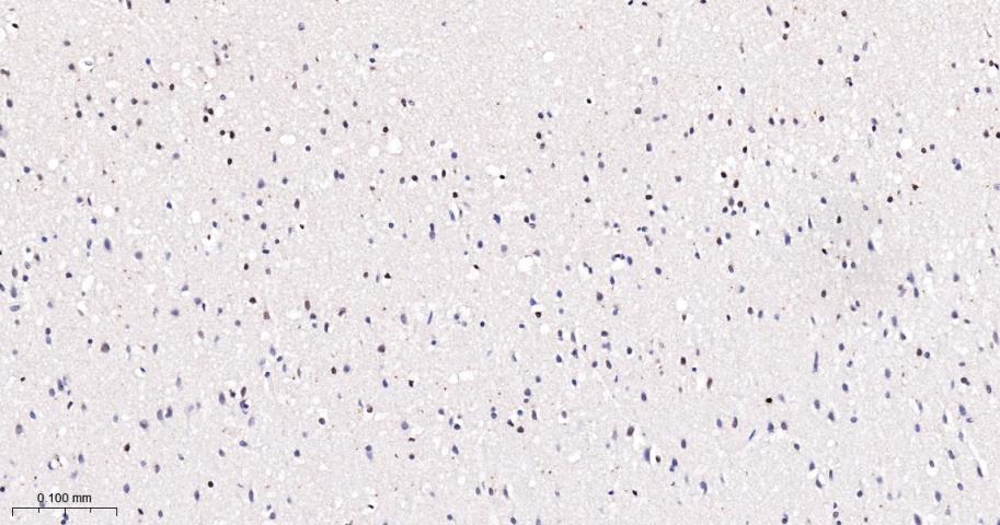 磷酸化信号转导和转录激活因子5a重组兔单抗-bsm-54554R