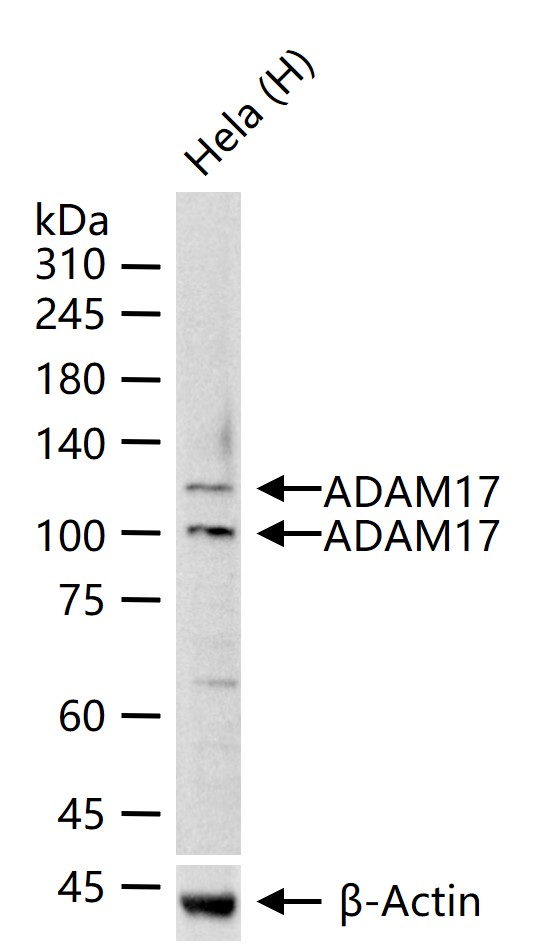 ADAM17重组兔单抗-bsm-52009R