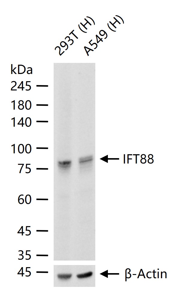 IFT88重组兔单抗-bsm-62706R