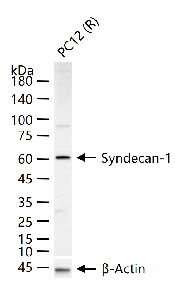 多配体蛋白聚糖1（CD138）重组兔单抗-bsm-52917R