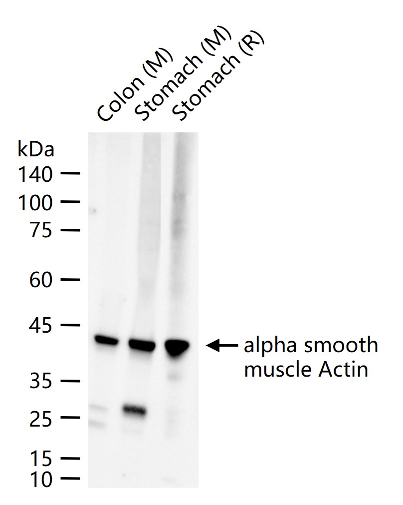 肌动蛋白α/α-SMA/α Actin重组兔单抗-bsm-33187R