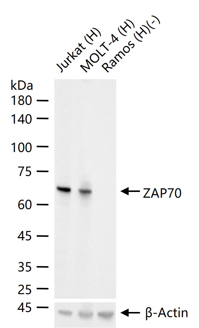 zeta相关蛋白70重组兔单抗-bsm-54192R