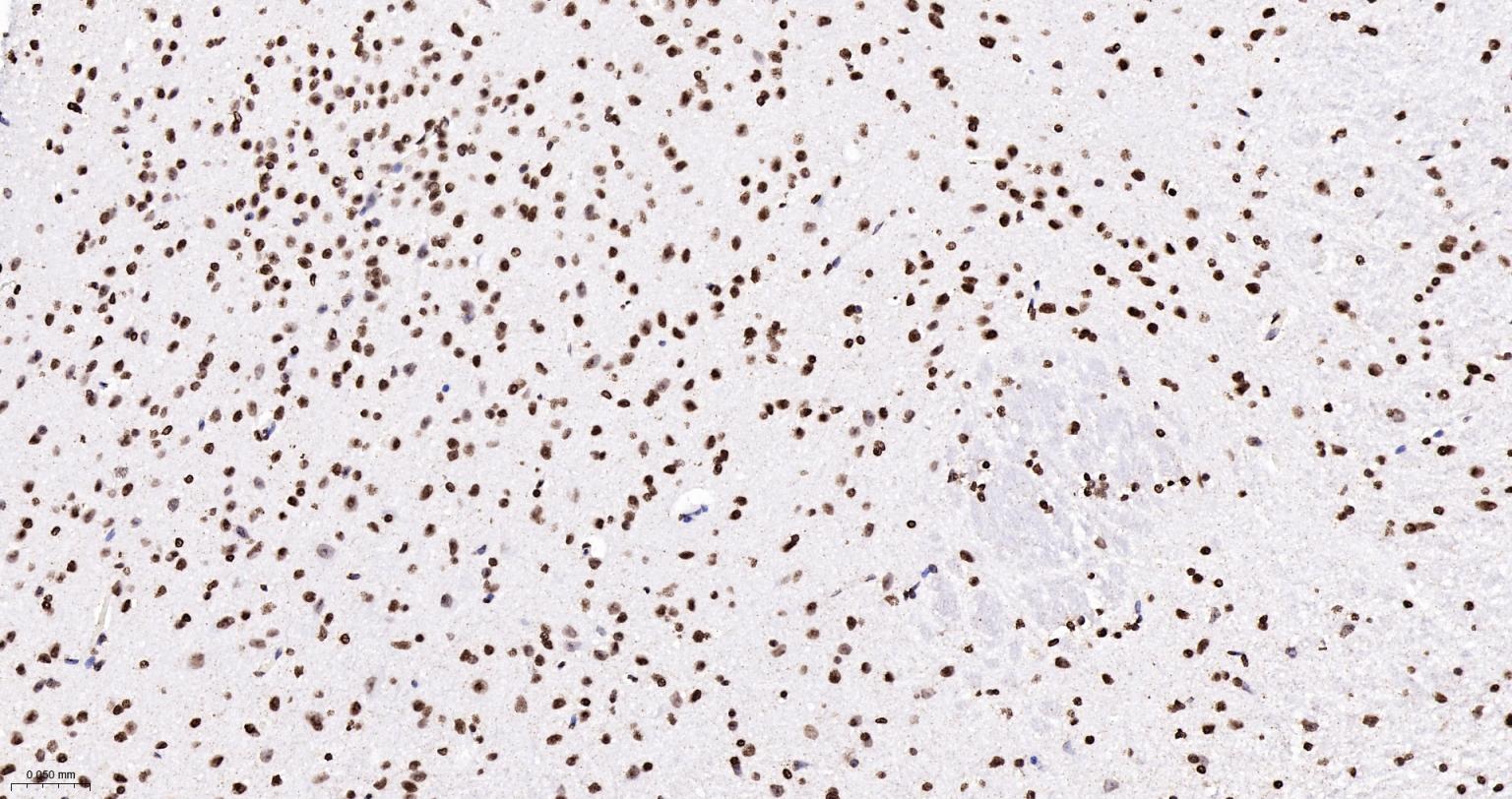 组蛋白H4重组兔单抗-bsm-52111R