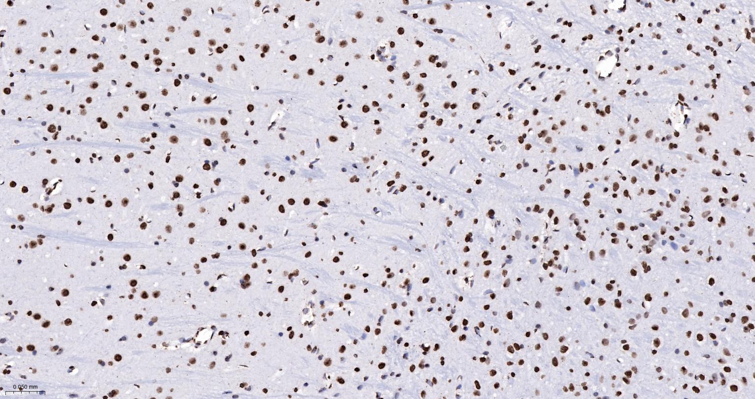 组蛋白H4重组兔单抗-bsm-52111R