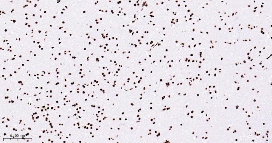 组蛋白H4重组兔单抗-bsm-52111R