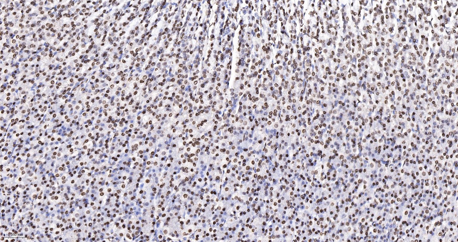 组蛋白H4重组兔单抗-bsm-52111R