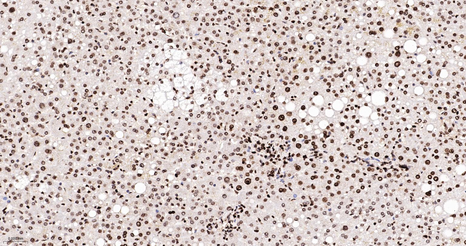 组蛋白H4重组兔单抗-bsm-52111R