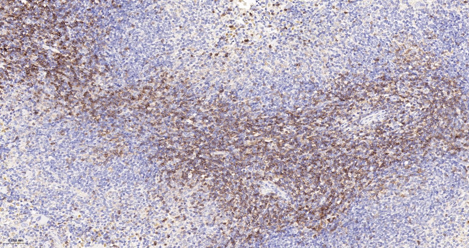 CD4重组兔单抗-bsm-55558R