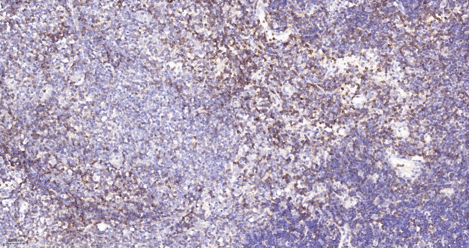CD4重组兔单抗-bsm-55558R