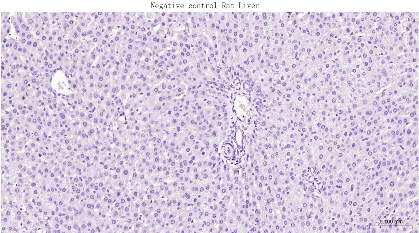 低分子量神经丝蛋白重组兔单抗-bsm-41217R