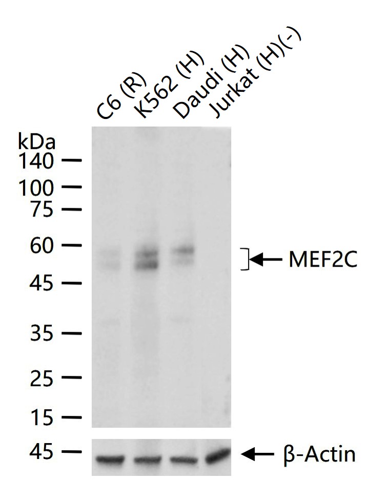 肌细胞增强因子2C重组兔单抗-bsm-62908R
