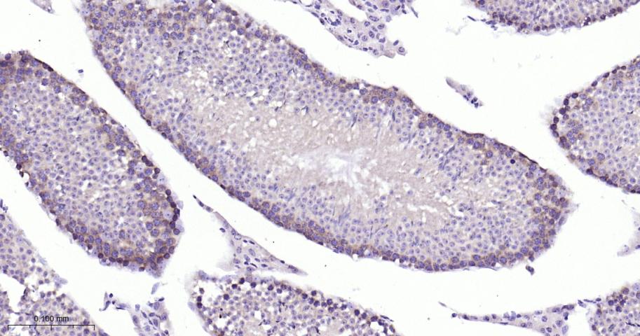 微管蛋白γ重组兔单抗-bsm-61186R