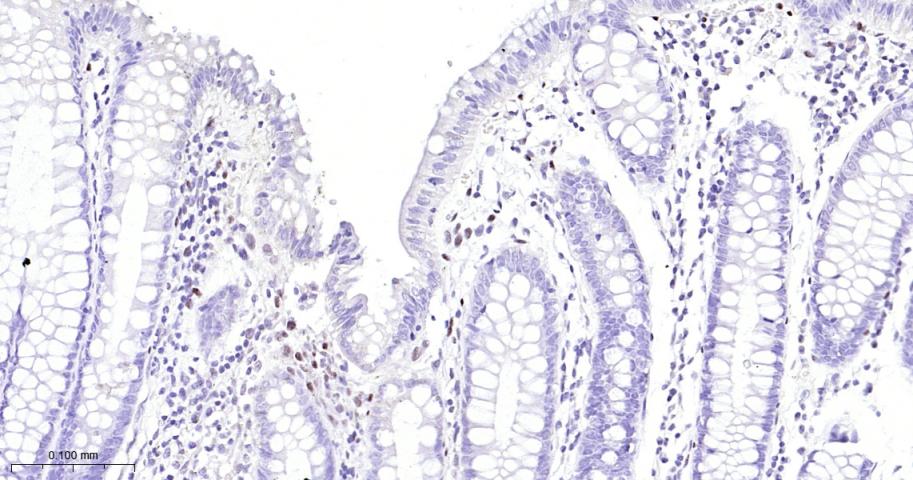 负调控因子白细胞介素2重组兔单抗-bsm-61689R