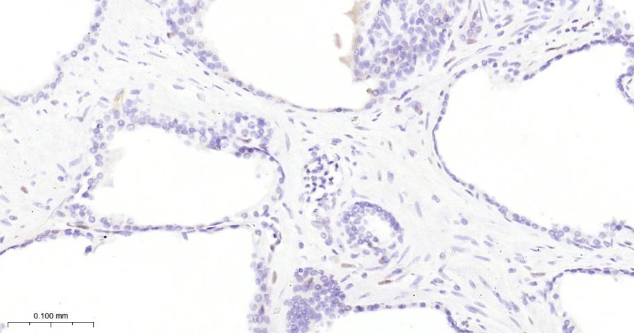 负调控因子白细胞介素2重组兔单抗-bsm-61689R