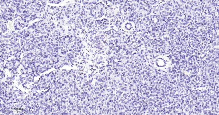负调控因子白细胞介素2重组兔单抗-bsm-61689R