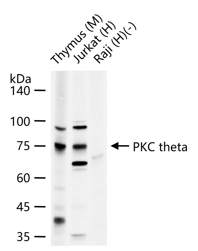 蛋白激酶C theta重组兔单抗-bsm-61824R