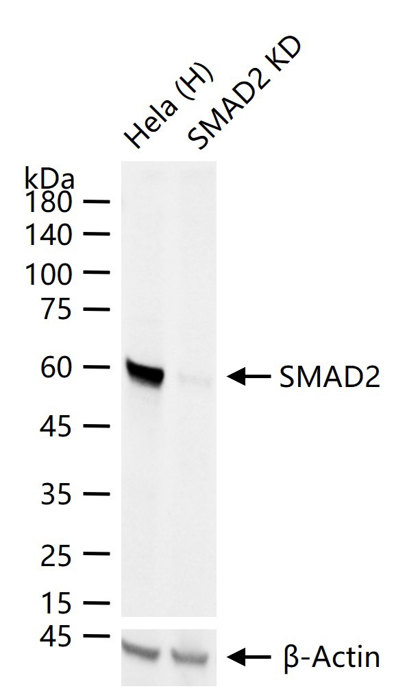 细胞信号转导分子Smad-2重组兔单抗-bsm-52223R