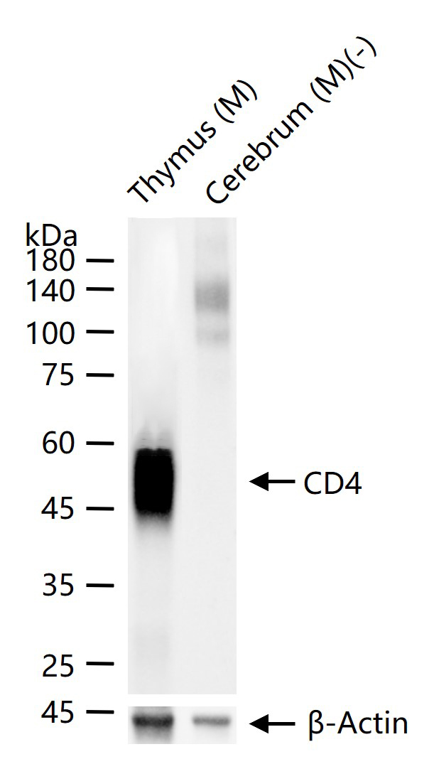 CD4重组兔单抗-bsm-55558R