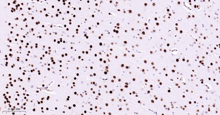 肌细胞增强因子2C重组兔单抗-bsm-62908R