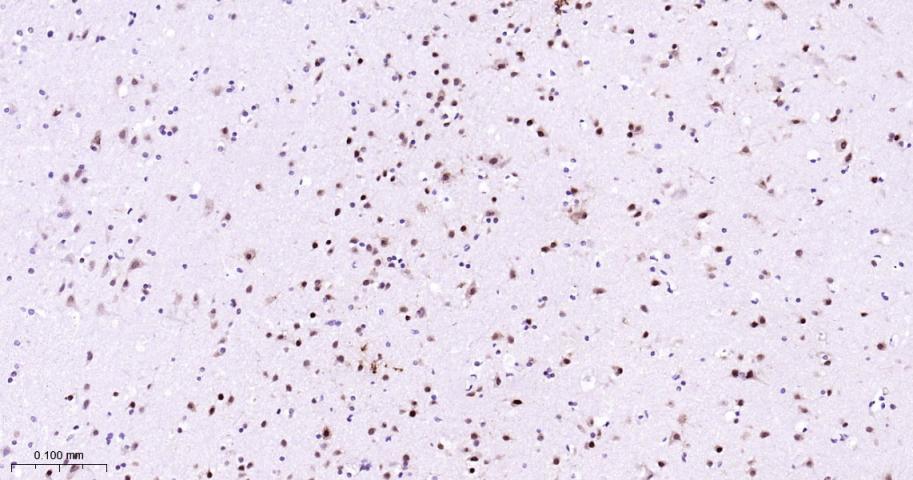 肌细胞增强因子2C重组兔单抗-bsm-62908R