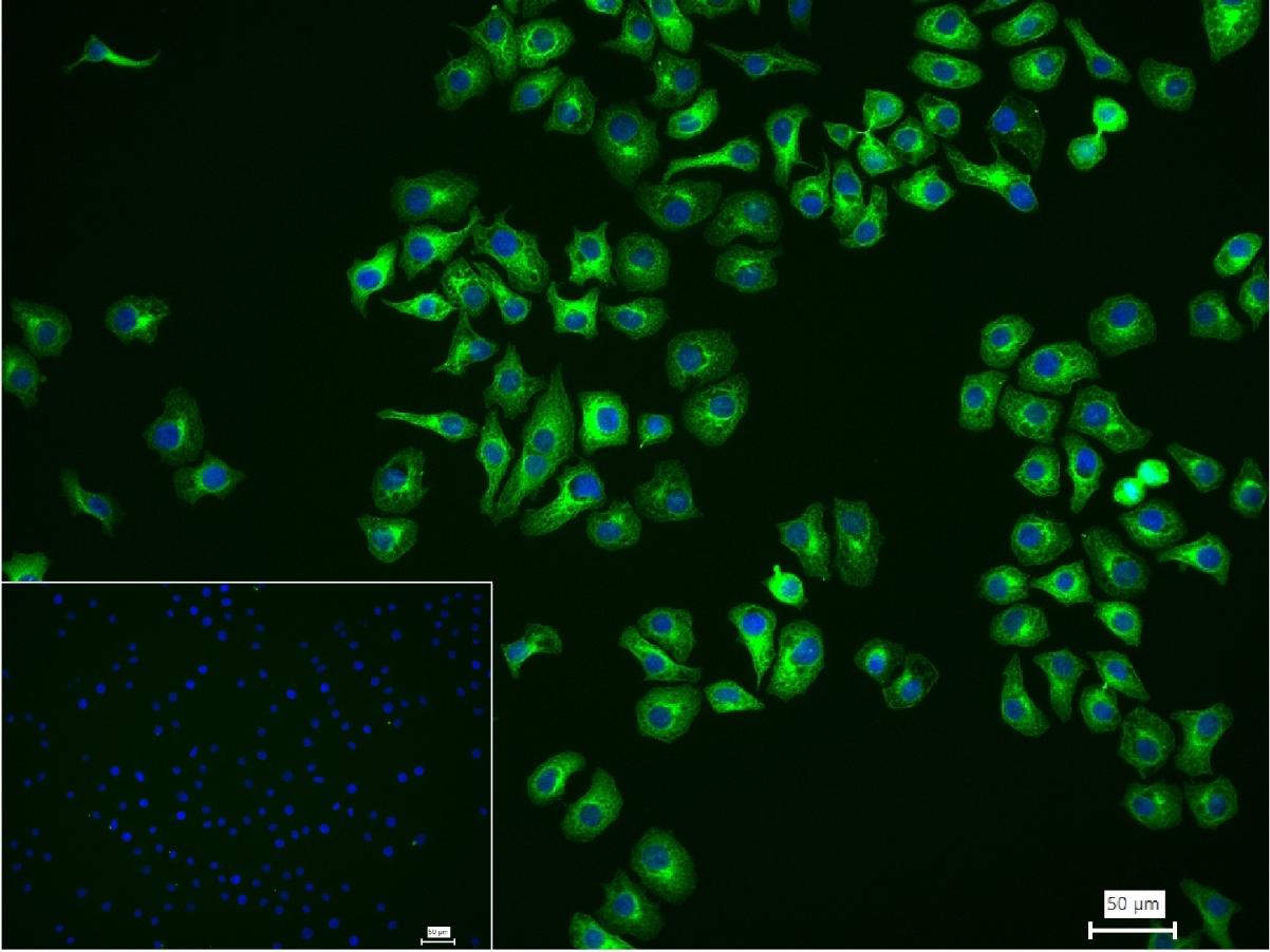 微管蛋白β1 tubulin(内参)重组兔单抗-bsm-33041R