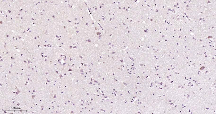 细胞信号转导分子Smad-1重组兔单抗-bsm-52222R