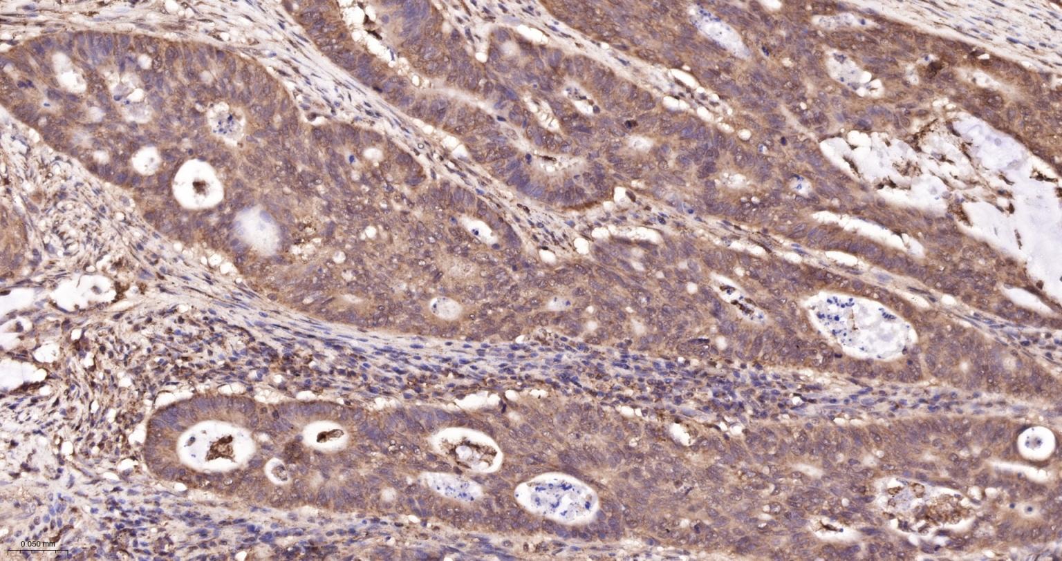 p38 MAPK重组兔单抗-bsm-55529R