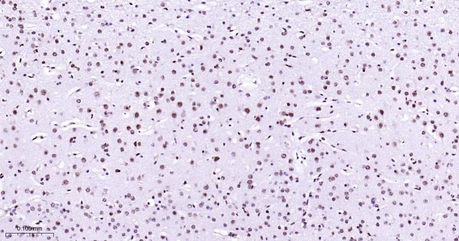 丝裂原活化蛋白激酶p38α重组兔单抗-bsm-63072R