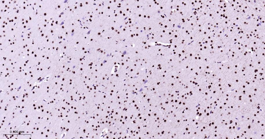 丝裂原活化蛋白激酶p38α重组兔单抗-bsm-63072R