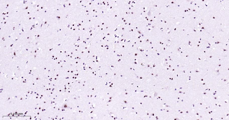 丝裂原活化蛋白激酶p38α重组兔单抗-bsm-63072R