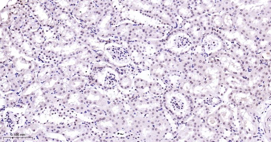 丝裂原活化蛋白激酶p38α重组兔单抗-bsm-63072R