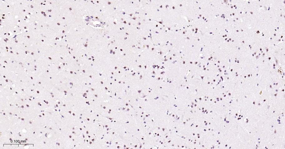 周期蛋白依赖激酶抑制因子1C重组兔单抗-bsm-61145R