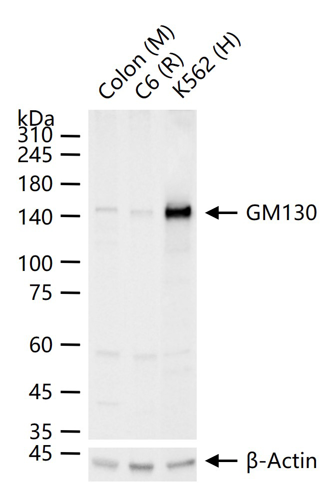 高尔基体自身蛋白GM130重组兔单抗-bsm-61120R