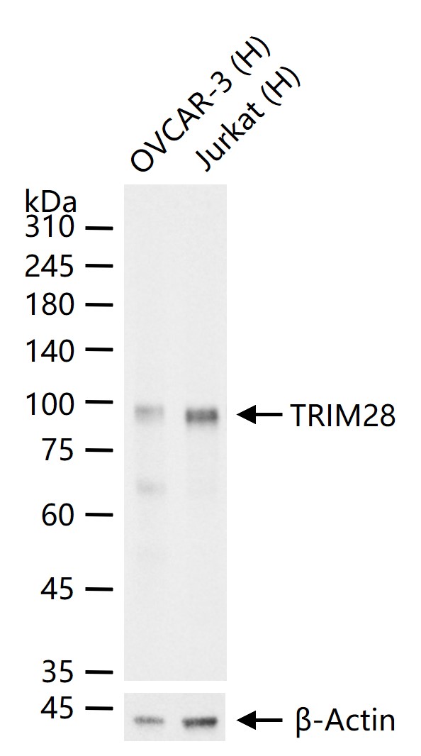 转录中介因子Tif1β重组兔单抗-bsm-63000R