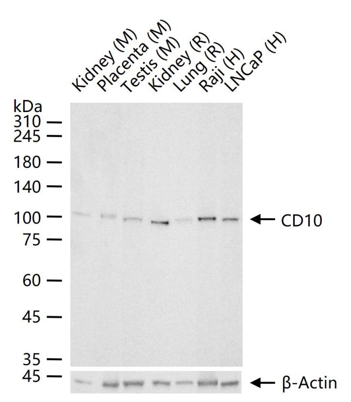 CD10重组兔单抗-bsm-62909R