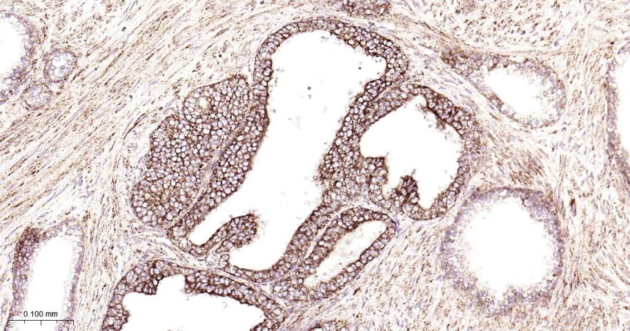 铬细胞瘤患者抑癌基因SDHB重组兔单抗-bsm-54180R