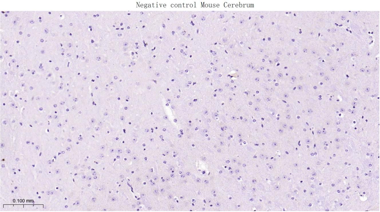CD4重组兔单抗-bsm-55558R